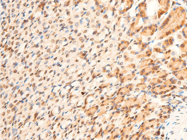 Phospho-p73 (Tyr99) Antibody in Immunohistochemistry (Paraffin) (IHC (P))