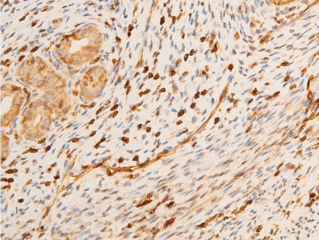 Phospho-p73 (Tyr99) Antibody in Immunohistochemistry (Paraffin) (IHC (P))