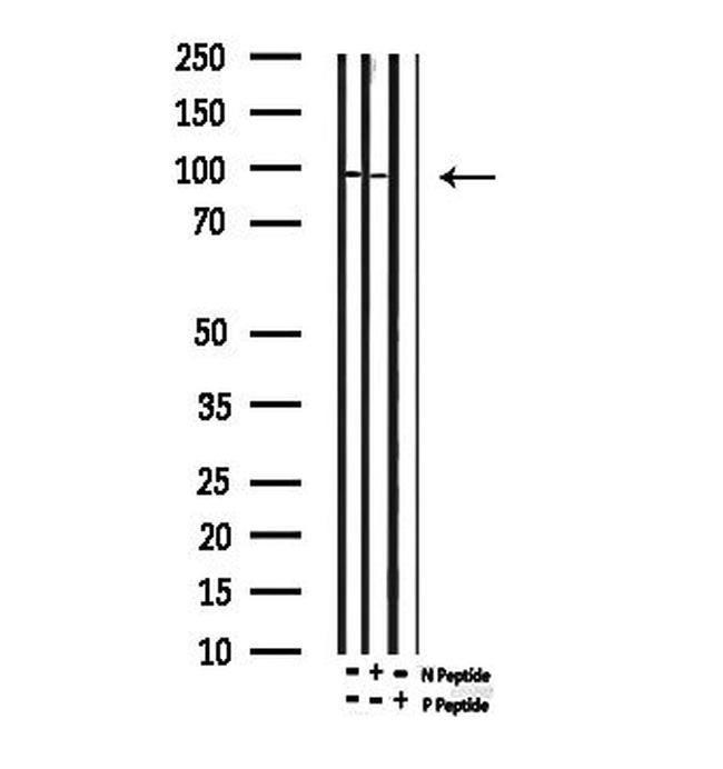Phospho-p73 (Tyr99) Antibody in Western Blot (WB)