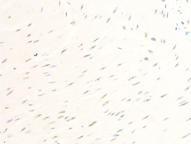 Phospho-Survivin (Thr117) Antibody in Immunohistochemistry (Paraffin) (IHC (P))