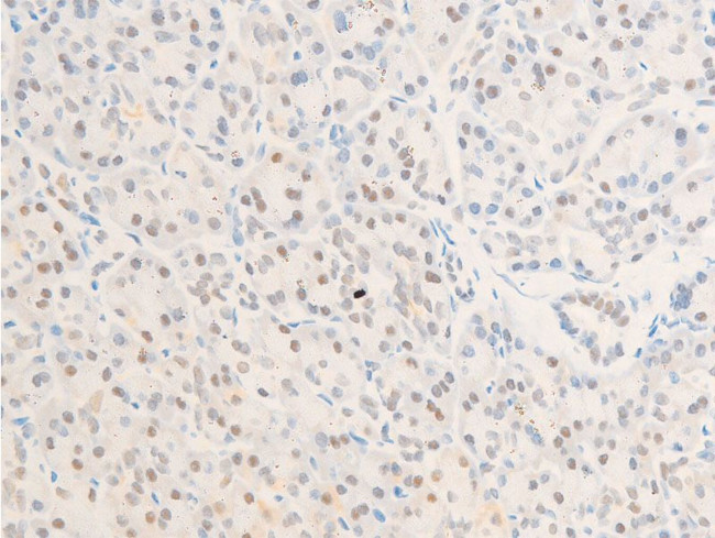 Phospho-Survivin (Thr117) Antibody in Immunohistochemistry (Paraffin) (IHC (P))