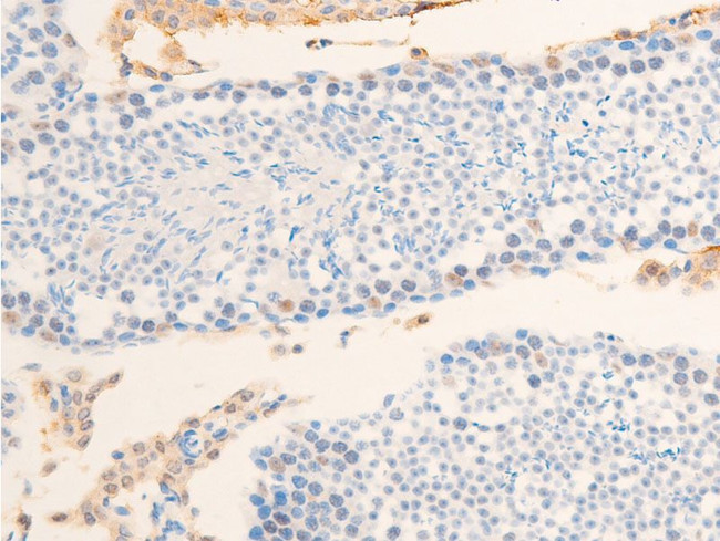 Phospho-Survivin (Thr117) Antibody in Immunohistochemistry (Paraffin) (IHC (P))