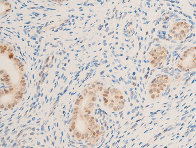 Phospho-Survivin (Thr117) Antibody in Immunohistochemistry (Paraffin) (IHC (P))