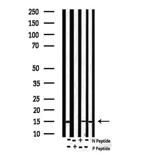 Phospho-Survivin (Thr117) Antibody in Western Blot (WB)