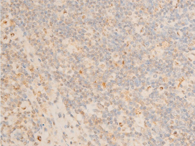 Phospho-PDPK1 (Ser241) Antibody in Immunohistochemistry (Paraffin) (IHC (P))