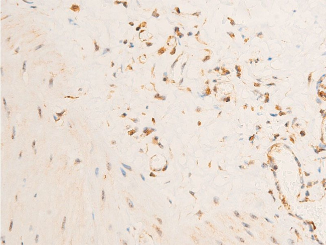 Phospho-PDPK1 (Ser241) Antibody in Immunohistochemistry (Paraffin) (IHC (P))