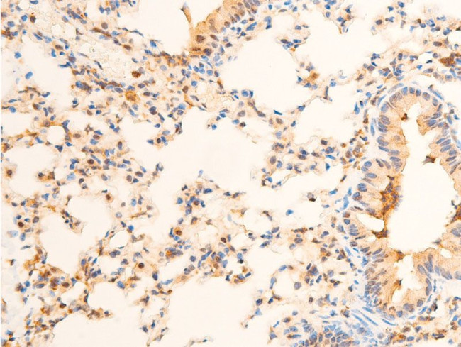 Phospho-PDPK1 (Ser241) Antibody in Immunohistochemistry (Paraffin) (IHC (P))