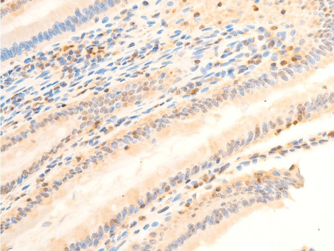 Phospho-PDPK1 (Ser241) Antibody in Immunohistochemistry (Paraffin) (IHC (P))