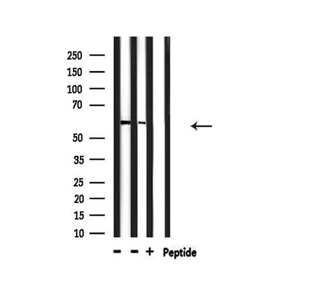 Phospho-PDPK1 (Ser241) Antibody in Western Blot (WB)