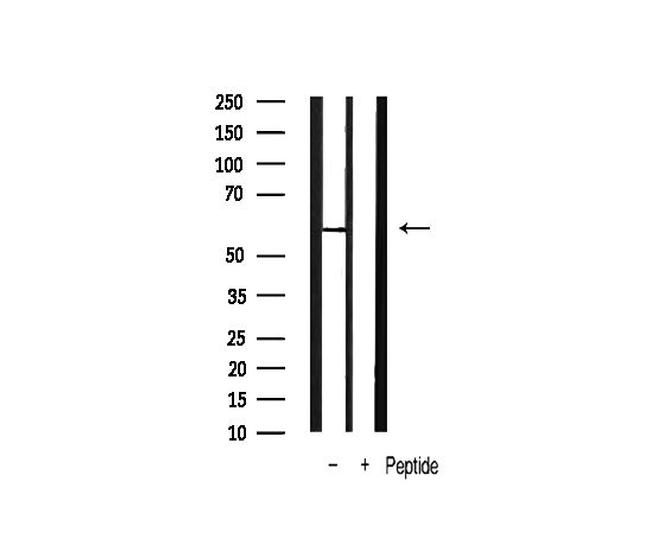 Phospho-PDPK1 (Ser241) Antibody in Western Blot (WB)