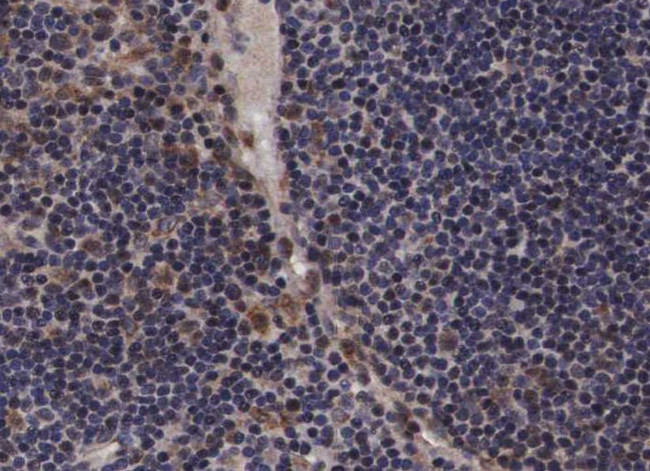 Phospho-JAK2 (Tyr221) Antibody in Immunohistochemistry (Paraffin) (IHC (P))