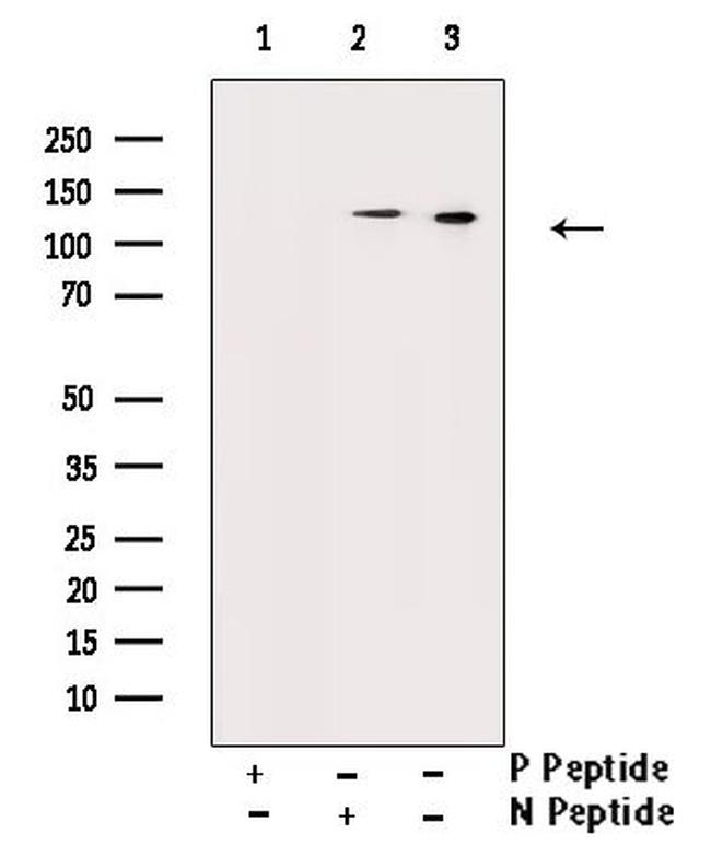 Phospho-JAK2 (Tyr570) Antibody in Western Blot (WB)