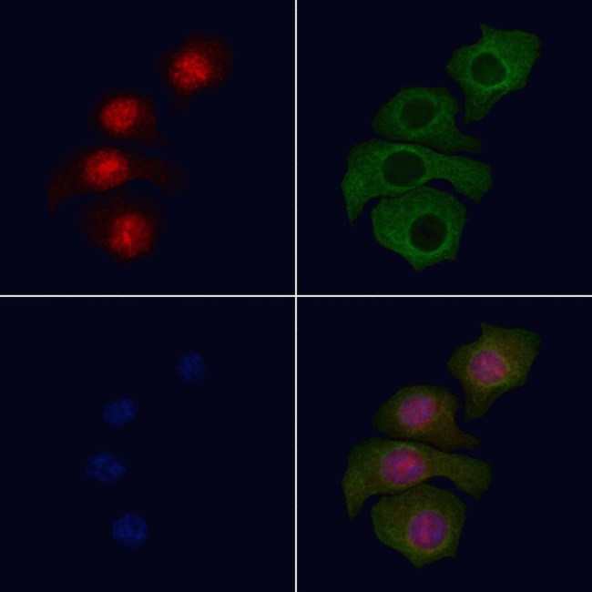 Phospho-MiTF (Ser180) Antibody in Immunocytochemistry (ICC/IF)