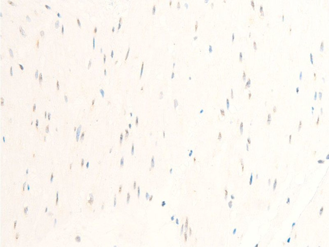 Phospho-MiTF (Ser180) Antibody in Immunohistochemistry (Paraffin) (IHC (P))