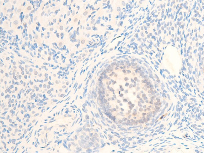 Phospho-MiTF (Ser180) Antibody in Immunohistochemistry (Paraffin) (IHC (P))