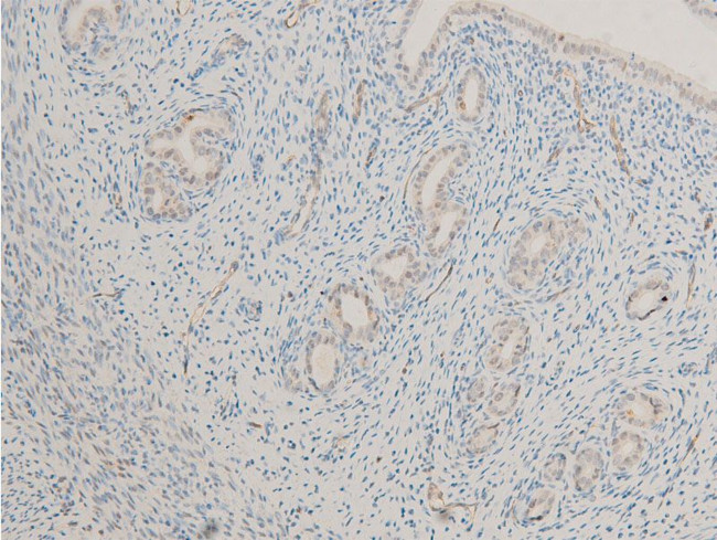 Phospho-MiTF (Ser180) Antibody in Immunohistochemistry (Paraffin) (IHC (P))