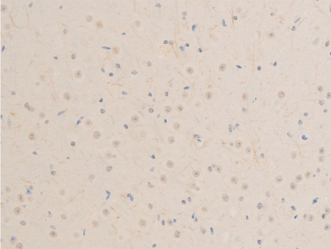 Phospho-MiTF (Ser180) Antibody in Immunohistochemistry (Paraffin) (IHC (P))