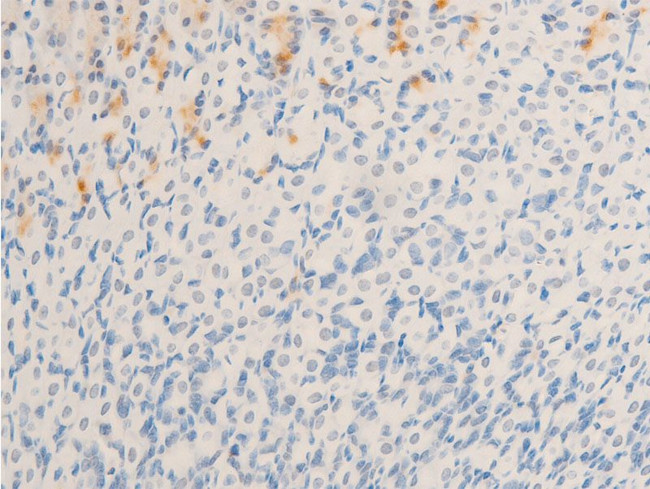 Phospho-MiTF (Ser180) Antibody in Immunohistochemistry (Paraffin) (IHC (P))