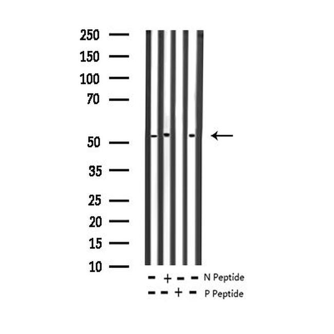 Phospho-MiTF (Ser180) Antibody in Western Blot (WB)