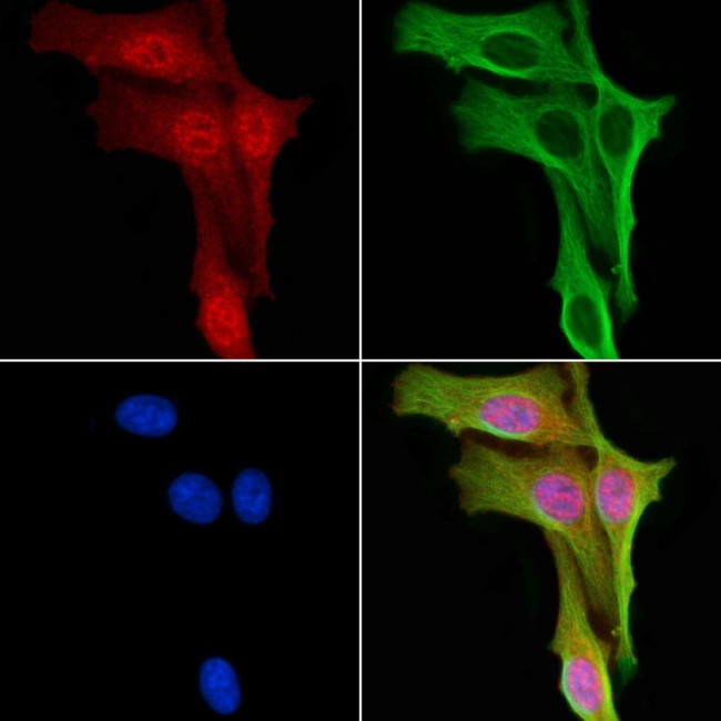 Phospho-MSK1 (Ser212) Antibody in Immunocytochemistry (ICC/IF)