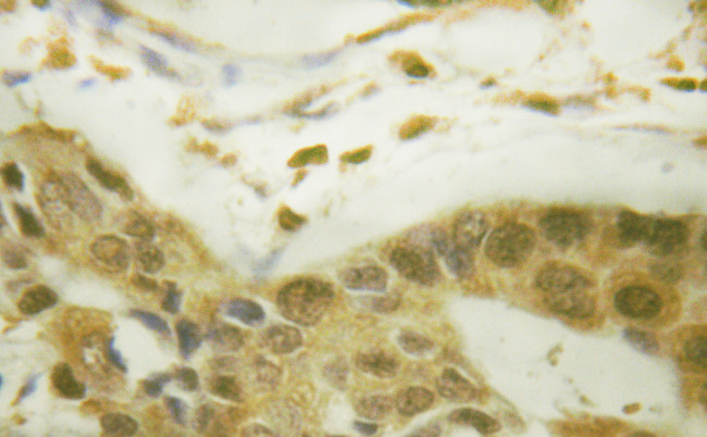 Phospho-MSK1 (Ser212) Antibody in Immunohistochemistry (IHC)