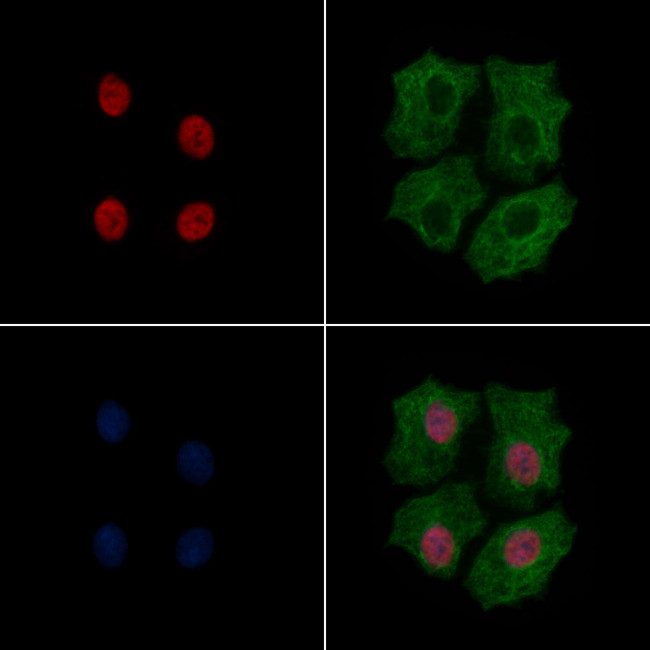 Phospho-SNAIL (Ser246) Antibody in Immunocytochemistry (ICC/IF)