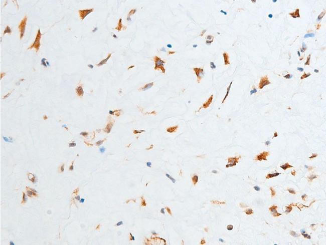 Phospho-Chk2 (Thr387) Antibody in Immunohistochemistry (Paraffin) (IHC (P))