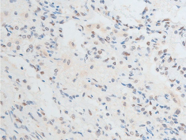 Phospho-Chk2 (Thr387) Antibody in Immunohistochemistry (Paraffin) (IHC (P))