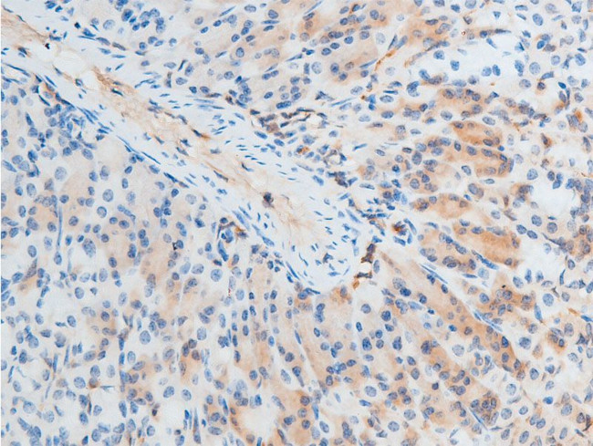 Phospho-Chk2 (Thr387) Antibody in Immunohistochemistry (Paraffin) (IHC (P))