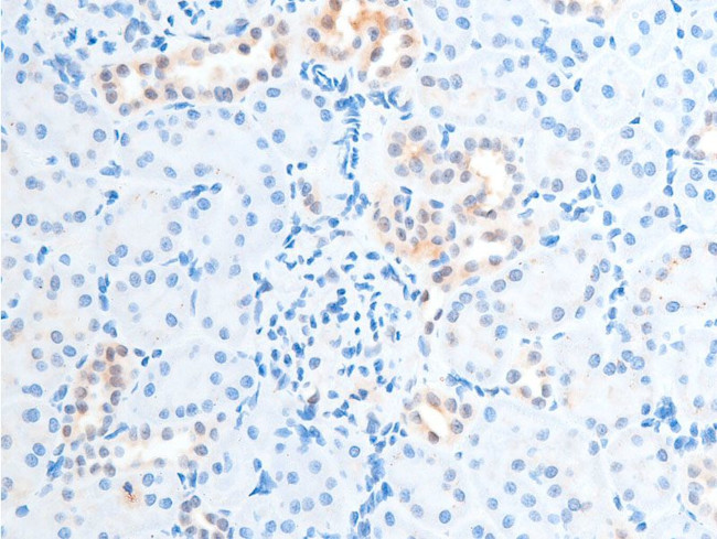 Phospho-Chk2 (Thr387) Antibody in Immunohistochemistry (Paraffin) (IHC (P))