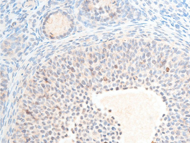 Phospho-Chk2 (Thr387) Antibody in Immunohistochemistry (Paraffin) (IHC (P))