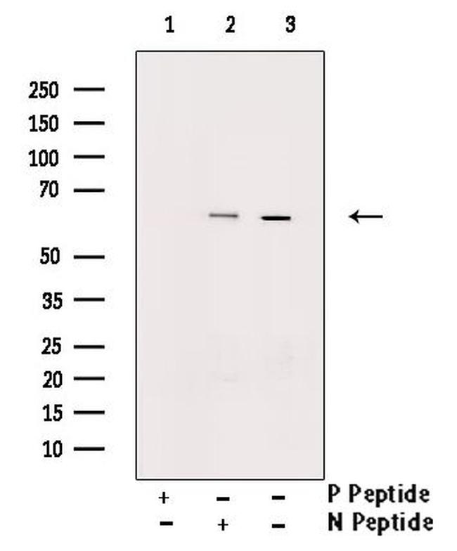 Phospho-Chk2 (Thr387) Antibody in Western Blot (WB)