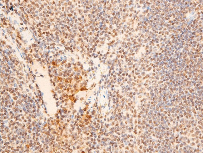 Phospho-Chk2 (Thr383) Antibody in Immunohistochemistry (Paraffin) (IHC (P))