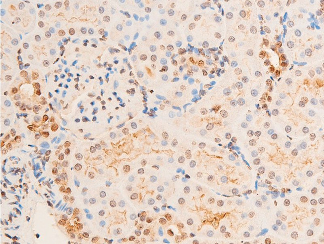 Phospho-Chk2 (Thr383) Antibody in Immunohistochemistry (Paraffin) (IHC (P))