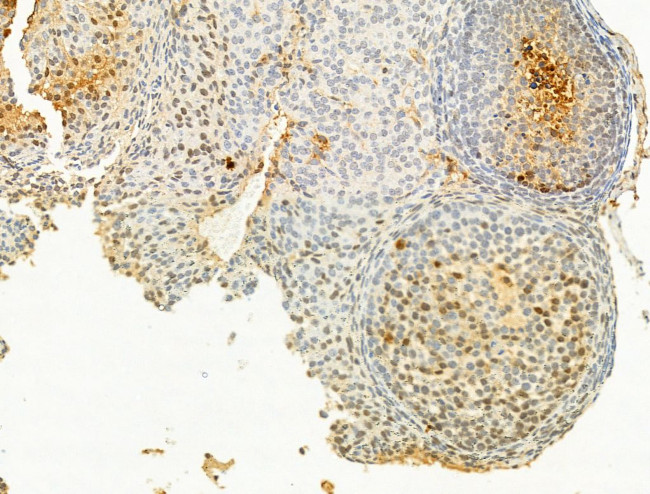 Phospho-Chk2 (Thr68) Antibody in Immunohistochemistry (Paraffin) (IHC (P))