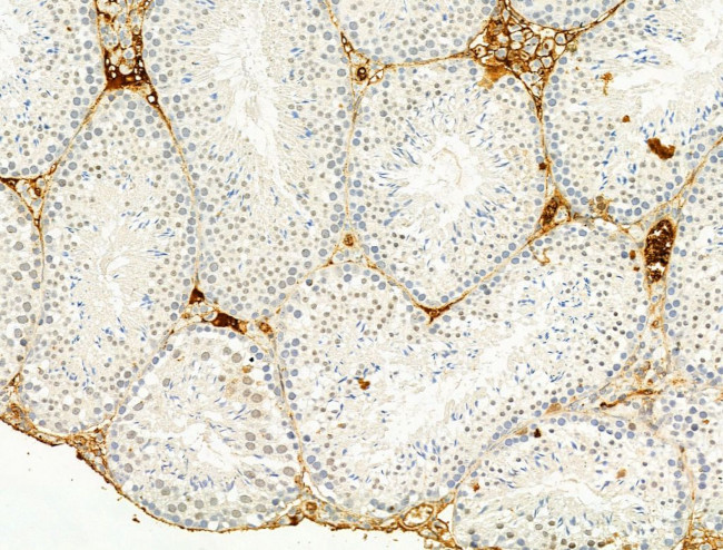 Phospho-Chk2 (Thr68) Antibody in Immunohistochemistry (Paraffin) (IHC (P))