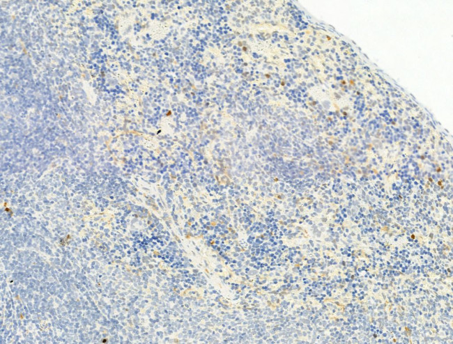 Phospho-Chk2 (Thr68) Antibody in Immunohistochemistry (Paraffin) (IHC (P))