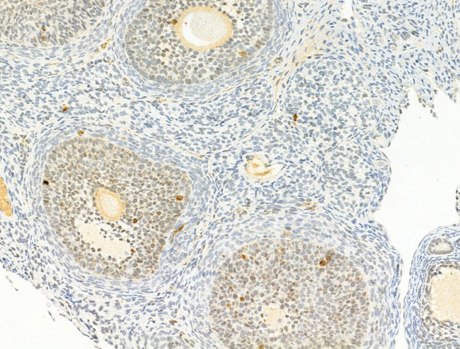 Phospho-Chk2 (Thr68) Antibody in Immunohistochemistry (Paraffin) (IHC (P))