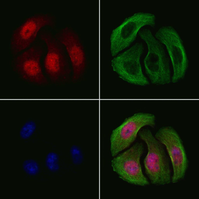 Phospho-Chk2 (Thr68) Antibody in Immunocytochemistry (ICC/IF)