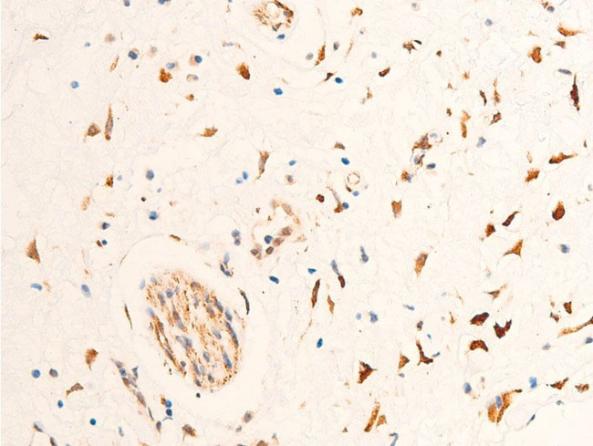 Phospho-Chk2 (Thr68) Antibody in Immunohistochemistry (Paraffin) (IHC (P))