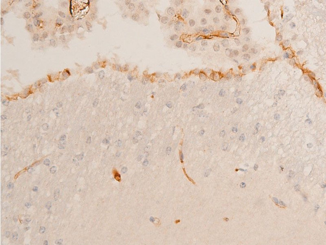 Phospho-Chk2 (Thr68) Antibody in Immunohistochemistry (Paraffin) (IHC (P))