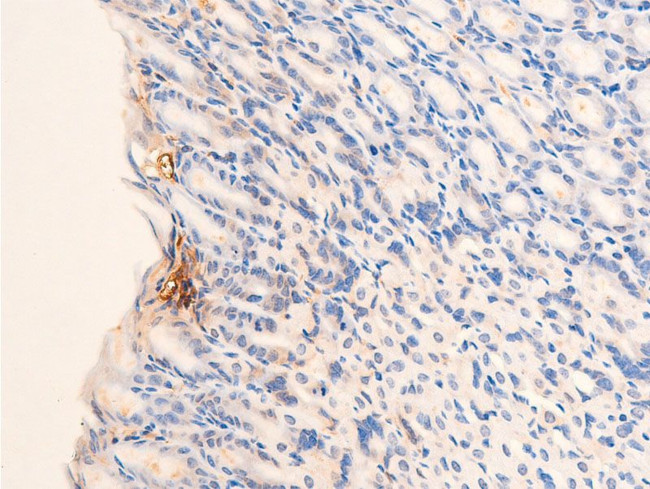 Phospho-Chk2 (Thr68) Antibody in Immunohistochemistry (Paraffin) (IHC (P))