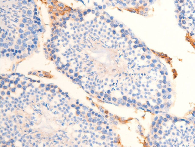 Phospho-Chk2 (Thr68) Antibody in Immunohistochemistry (Paraffin) (IHC (P))