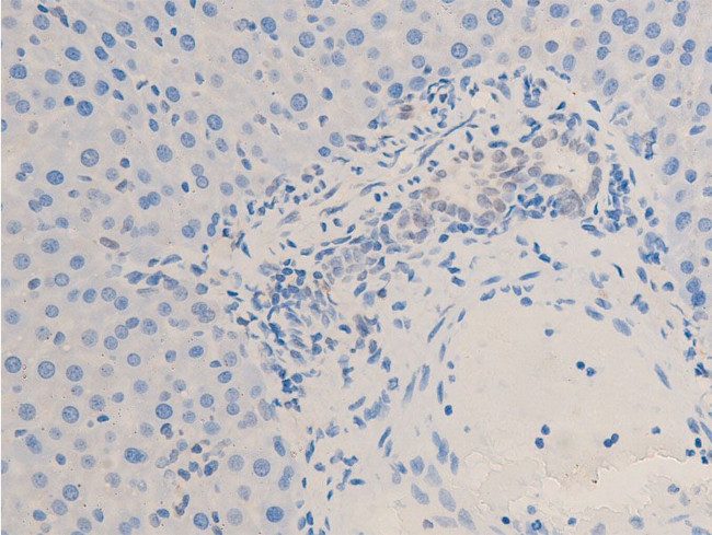 Phospho-Chk2 (Thr68) Antibody in Immunohistochemistry (Paraffin) (IHC (P))