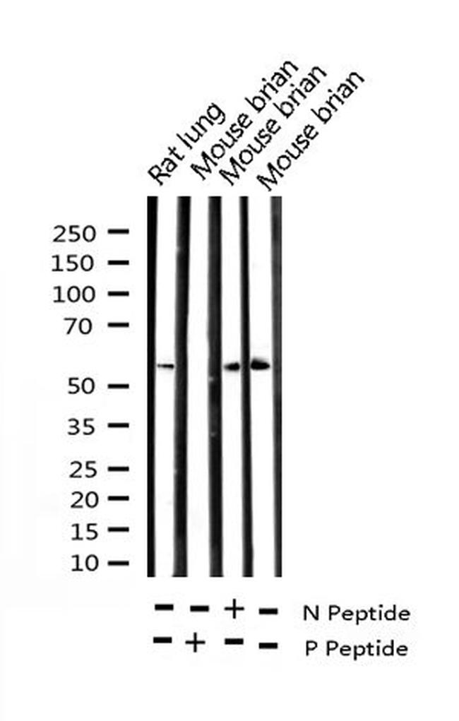 Phospho-Chk2 (Thr68) Antibody in Western Blot (WB)