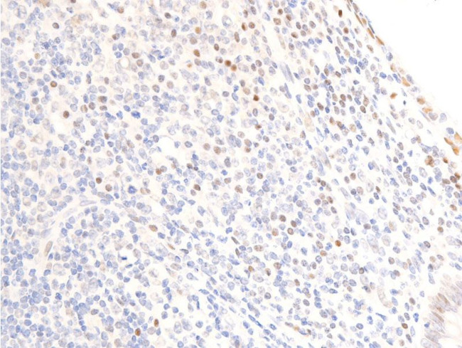 Phospho-EGFR (Ser1071) Antibody in Immunohistochemistry (Paraffin) (IHC (P))