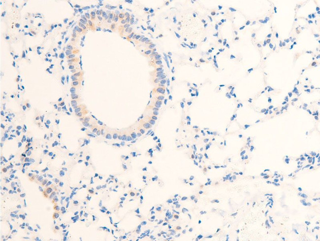 Phospho-EGFR (Ser1071) Antibody in Immunohistochemistry (Paraffin) (IHC (P))