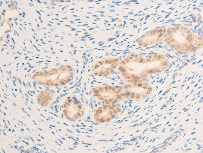 Phospho-EGFR (Ser1071) Antibody in Immunohistochemistry (Paraffin) (IHC (P))