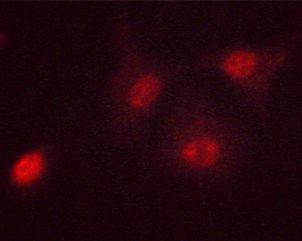 Phospho-c-Myc (Ser62) Antibody in Immunocytochemistry (ICC/IF)