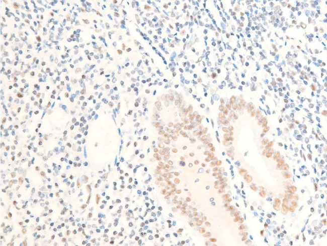 Phospho-c-Myc (Ser62) Antibody in Immunohistochemistry (Paraffin) (IHC (P))